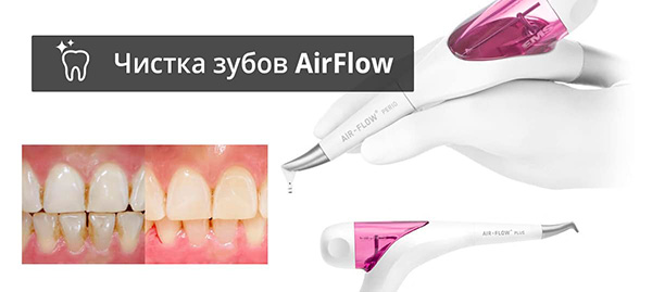 Чистка зубов AirFlow