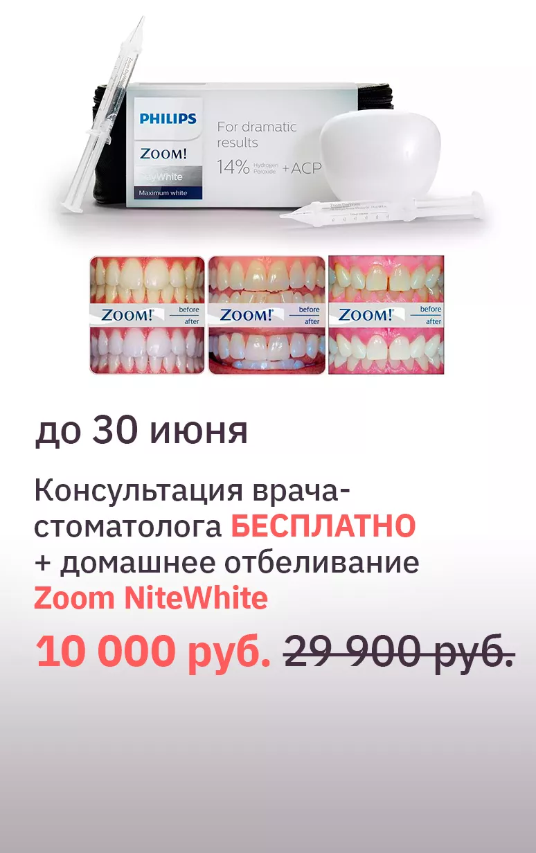 Домашнее отбеливание Philips Zoom Day White ACP | Стоматология Дентал Арт