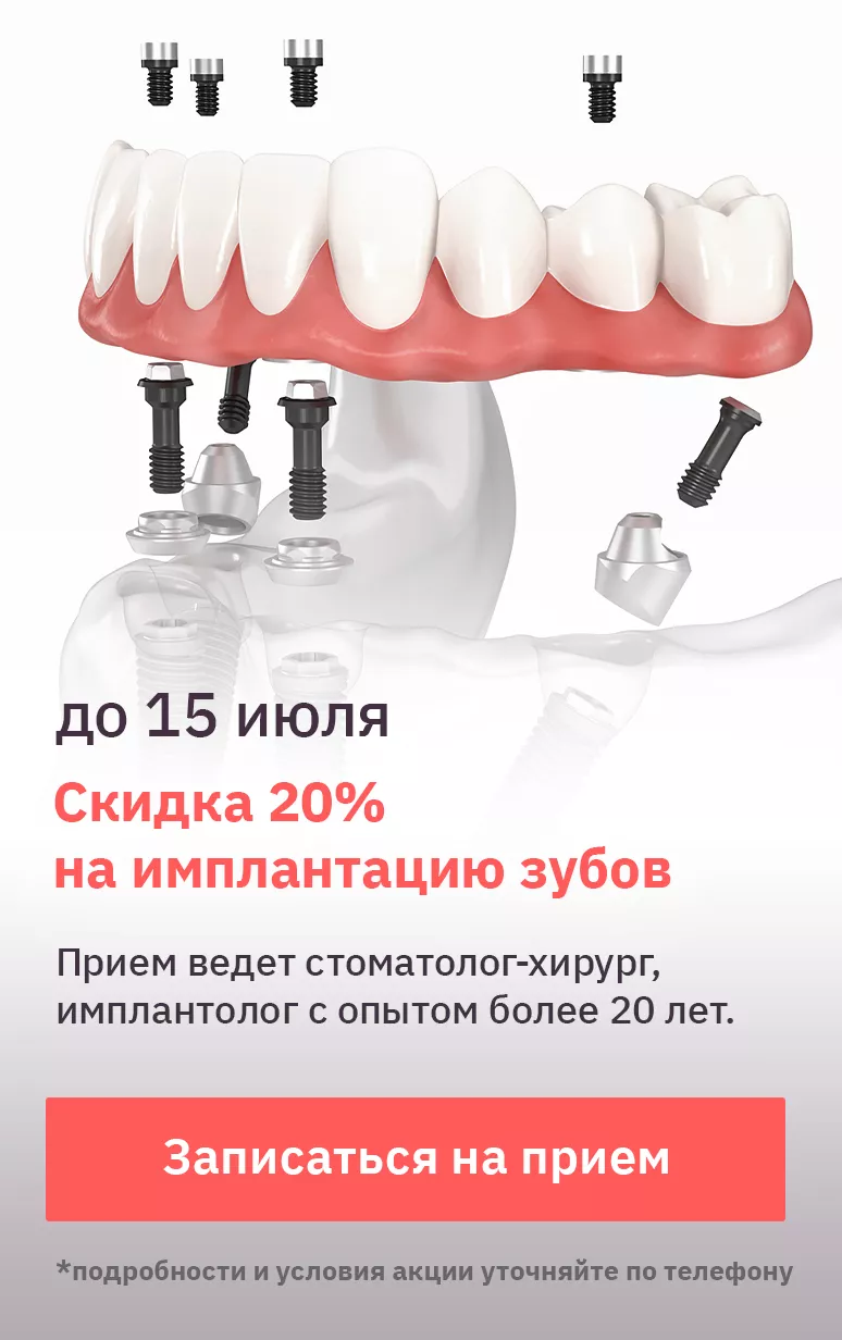 Импланты Dentium цена в Москве, имплантаты Дентиум | Стоматология Дентал Арт